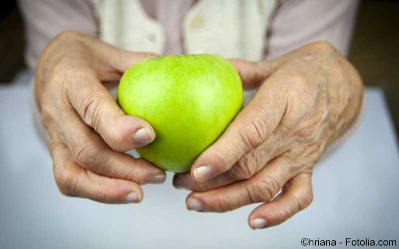 Rheumatoide Arthritis Rheumatoide Arthritis